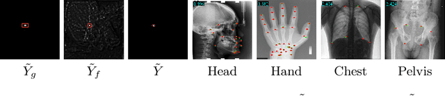 Figure 4 for DATR: Domain-adaptive transformer for multi-domain landmark detection