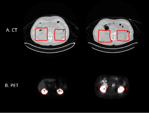 Figure 3 for Cross-Domain Federated Learning in Medical Imaging