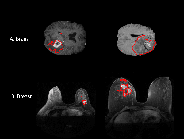 Figure 4 for Cross-Domain Federated Learning in Medical Imaging