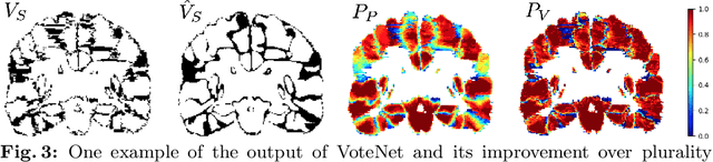 Figure 4 for VoteNet: A Deep Learning Label Fusion Method for Multi-Atlas Segmentation
