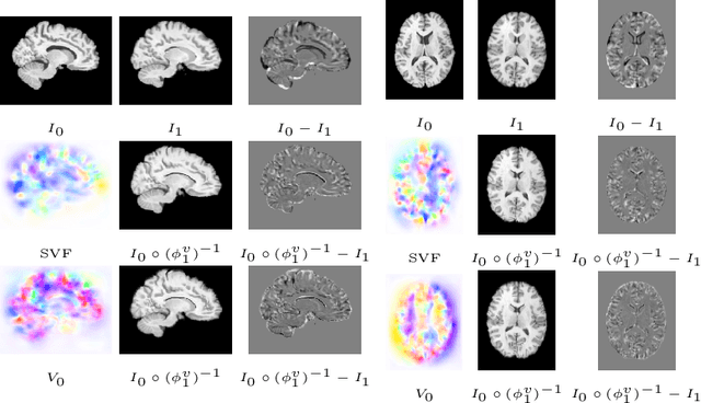 Figure 3 for LDDMM meets GANs: Generative Adversarial Networks for diffeomorphic registration