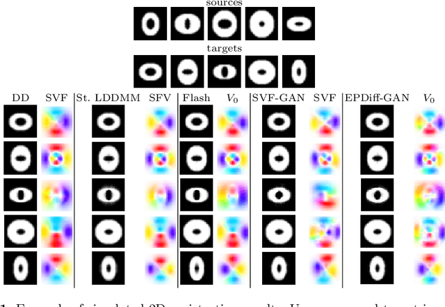 Figure 1 for LDDMM meets GANs: Generative Adversarial Networks for diffeomorphic registration