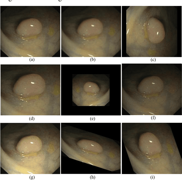Figure 2 for Automatic Colon Polyp Detection using Region based Deep CNN and Post Learning Approaches