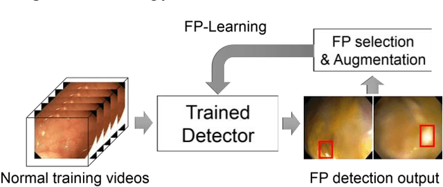 Figure 3 for Automatic Colon Polyp Detection using Region based Deep CNN and Post Learning Approaches
