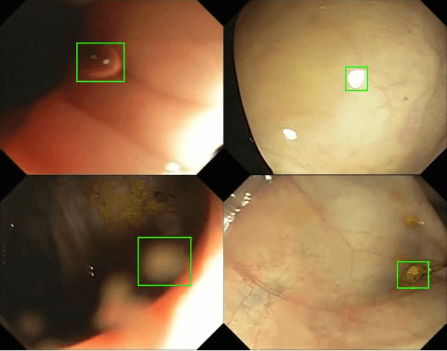 Figure 4 for Automatic Colon Polyp Detection using Region based Deep CNN and Post Learning Approaches
