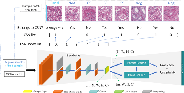 Figure 4 for Automatic Fine-grained Glomerular Lesion Recognition in Kidney Pathology