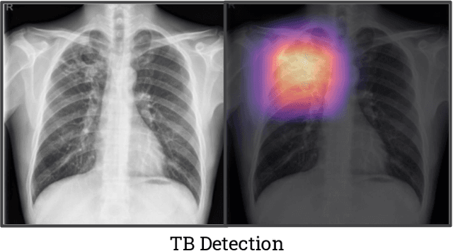 Figure 4 for CheXpedition: Investigating Generalization Challenges for Translation of Chest X-Ray Algorithms to the Clinical Setting