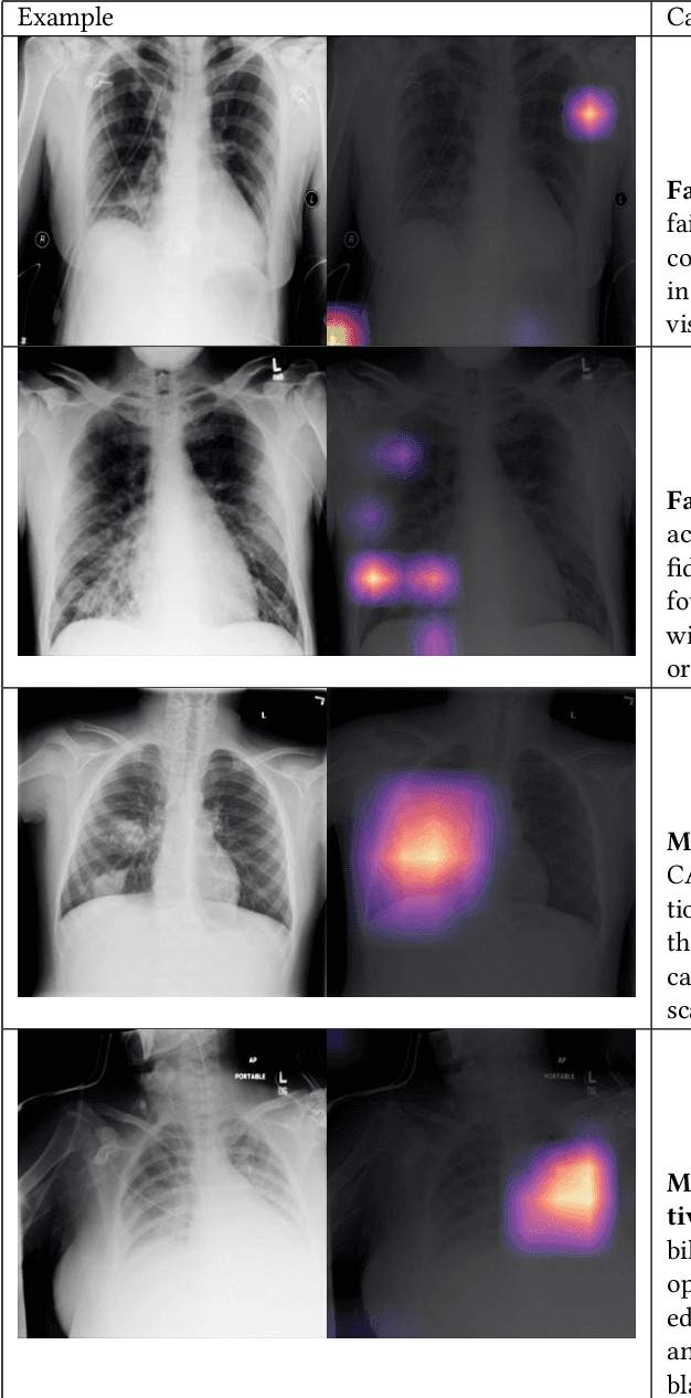 Figure 1 for CheXpedition: Investigating Generalization Challenges for Translation of Chest X-Ray Algorithms to the Clinical Setting