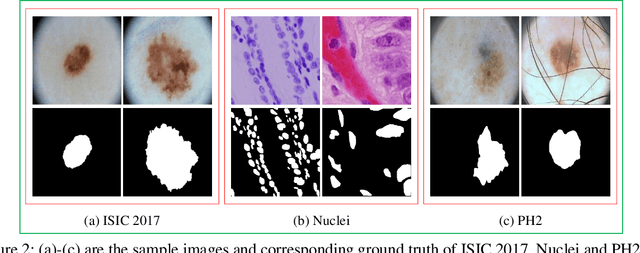 Figure 3 for PL-Net: Progressive Learning Network for Medical Image Segmentation