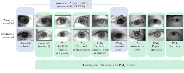 Figure 1 for State Of The Art In Open-Set Iris Presentation Attack Detection