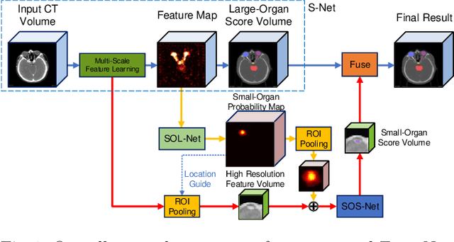 Figure 1 for FocusNet: Imbalanced Large and Small Organ Segmentation with an End-to-End Deep Neural Network for Head and Neck CT Images