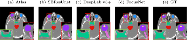 Figure 4 for FocusNet: Imbalanced Large and Small Organ Segmentation with an End-to-End Deep Neural Network for Head and Neck CT Images