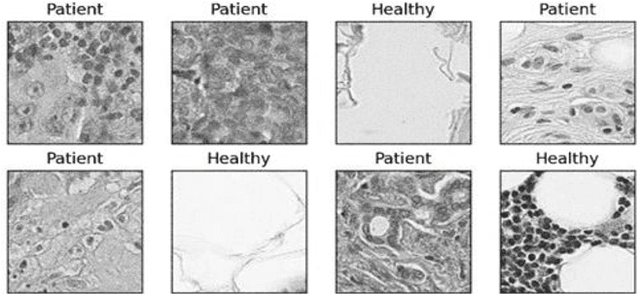 Figure 1 for Transfer learning for cancer diagnosis in histopathological images