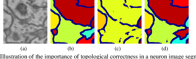 Figure 1 for Topology-Preserving Deep Image Segmentation