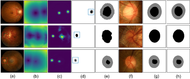 Figure 3 for JOINED : Prior Guided Multi-task Learning for Joint Optic Disc/Cup Segmentation and Fovea Detection