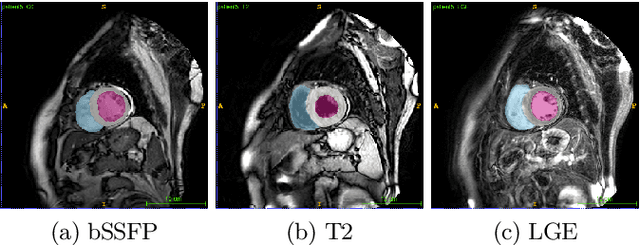 Figure 1 for Cardiac Segmentation of LGE MRI with Noisy Labels