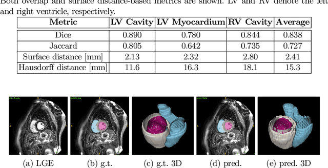 Figure 2 for Cardiac Segmentation of LGE MRI with Noisy Labels