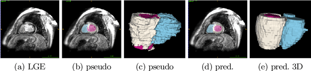 Figure 3 for Cardiac Segmentation of LGE MRI with Noisy Labels