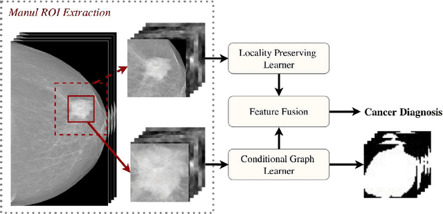Figure 2 for Dual Convolutional Neural Networks for BreastMass Segmentation and Diagnosis inMammography