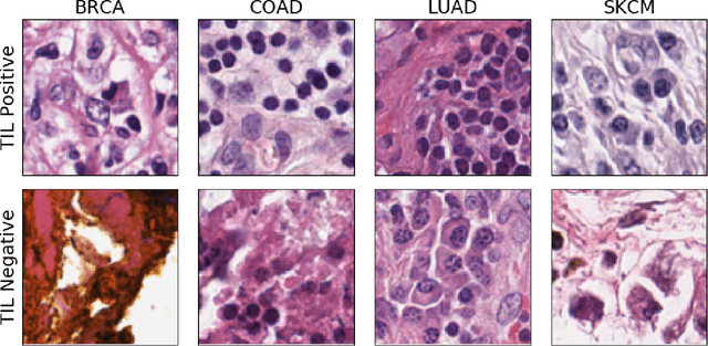 Figure 4 for Exascale Deep Learning to Accelerate Cancer Research
