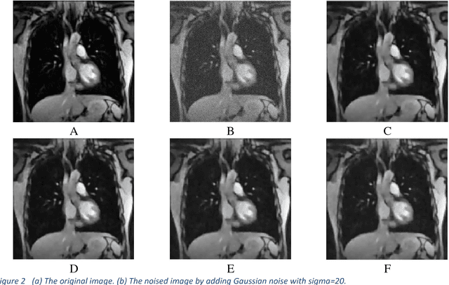Figure 3 for Sparse Representation and Non-Negative Matrix Factorization for image denoise
