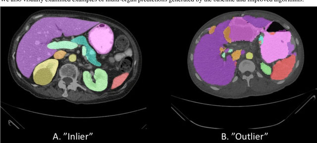 Figure 1 for Outlier Guided Optimization of Abdominal Segmentation
