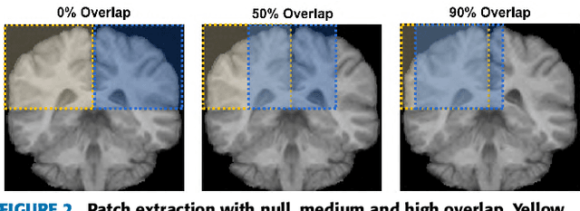 Figure 3 for Quantitative analysis of patch-based fully convolutional neural networks for tissue segmentation on brain magnetic resonance imaging