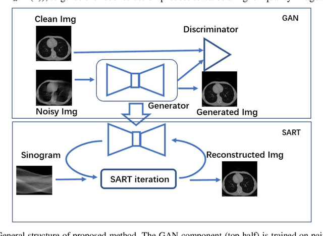 Figure 1 for Self-Attention Generative Adversarial Network for Iterative Reconstruction of CT Images