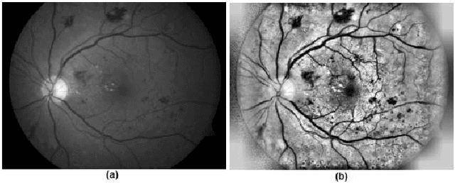 Figure 1 for Diabetic Retinopathy Detection using Ensemble Machine Learning