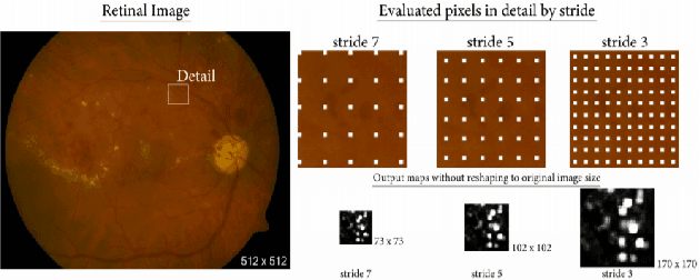 Figure 3 for Diabetic Retinopathy Detection using Ensemble Machine Learning