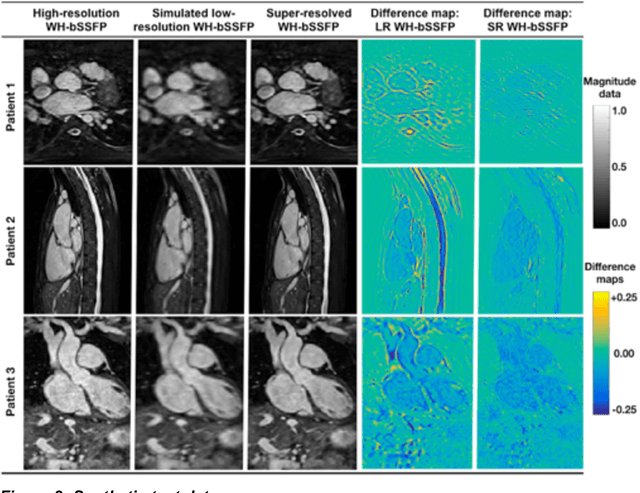 Figure 3 for Rapid Whole-Heart CMR with Single Volume Super-resolution