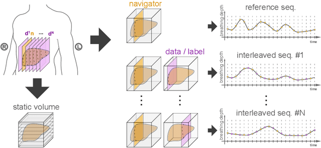 Figure 1 for Predicting 4D Liver MRI for MR-guided Interventions