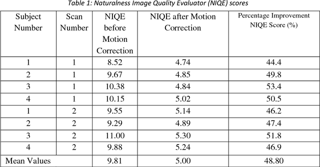 Figure 1 for MoCoNet: Motion Correction in 3D MPRAGE images using a Convolutional Neural Network approach