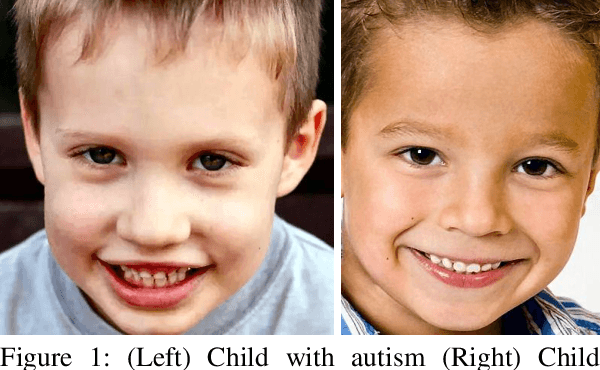 Figure 1 for Diagnosis of Autism in Children using Facial Analysis and Deep Learning