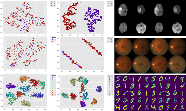 Figure 2 for Deep Variational Clustering Framework for Self-labeling of Large-scale Medical Images