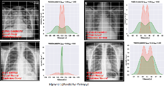 Figure 1 for Estimating Uncertainty and Interpretability in Deep Learning for Coronavirus (COVID-19) Detection