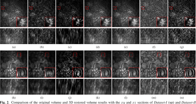 Figure 3 for Three dimensional blind image deconvolution for fluorescence microscopy using generative adversarial networks