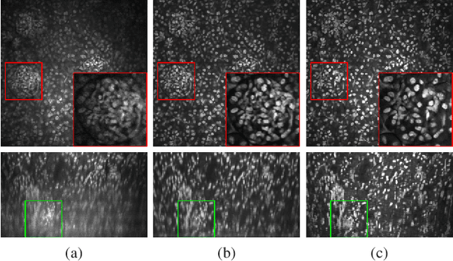 Figure 4 for Three dimensional blind image deconvolution for fluorescence microscopy using generative adversarial networks