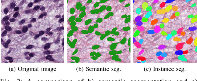 Figure 2 for Medical Image Segmentation with Limited Supervision: A Review of Deep Network Models