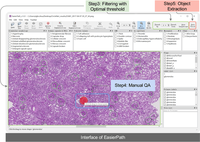 Figure 3 for EasierPath: An Open-source Tool for Human-in-the-loop Deep Learning of Renal Pathology