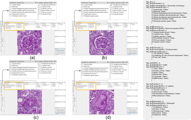 Figure 4 for EasierPath: An Open-source Tool for Human-in-the-loop Deep Learning of Renal Pathology