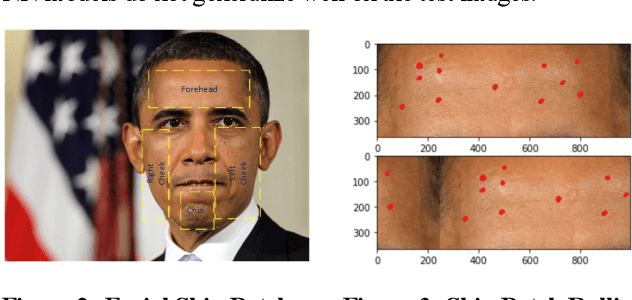 Figure 3 for A Computer Vision Application for Assessing Facial Acne Severity from Selfie Images