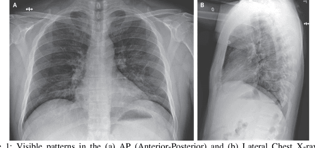 Figure 1 for CovMUNET: A Multiple Loss Approach towards Detection of COVID-19 from Chest X-ray