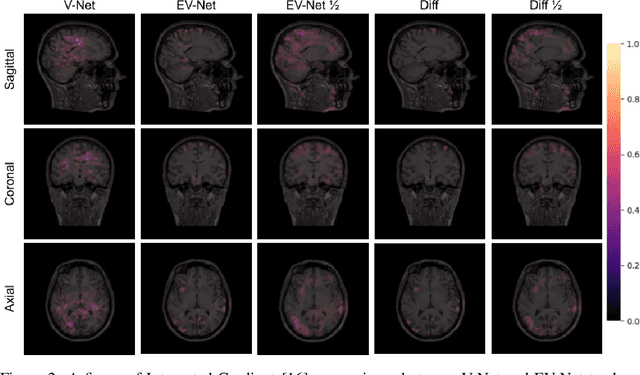 Figure 3 for EVC-Net: Multi-scale V-Net with Conditional Random Fields for Brain Extraction