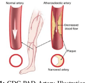 Figure 1 for Waveform Phasicity Prediction from Arterial Sounds through Spectogram Analysis using Convolutional Neural Networks for Limb Perfusion Assessment