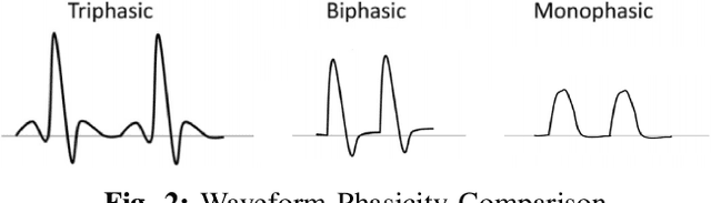 Figure 2 for Waveform Phasicity Prediction from Arterial Sounds through Spectogram Analysis using Convolutional Neural Networks for Limb Perfusion Assessment