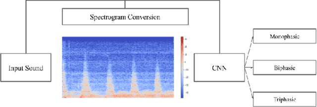 Figure 3 for Waveform Phasicity Prediction from Arterial Sounds through Spectogram Analysis using Convolutional Neural Networks for Limb Perfusion Assessment