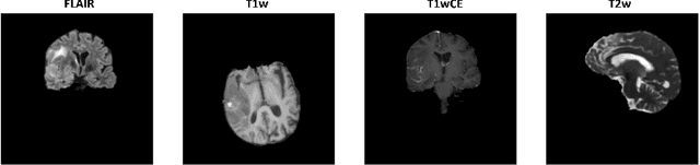 Figure 1 for Is it Possible to Predict MGMT Promoter Methylation from Brain Tumor MRI Scans using Deep Learning Models?