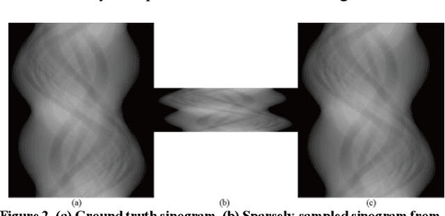 Figure 2 for Deep-neural-network based sinogram synthesis for sparse-view CT image reconstruction