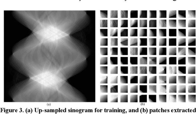 Figure 3 for Deep-neural-network based sinogram synthesis for sparse-view CT image reconstruction